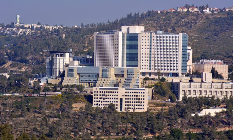 "סובב הדסה – עין כרם" במיקום היפהפה ביותר בירושלים: יחידות קרקע אחרונות ב-399 אלף ש"ח בלבד