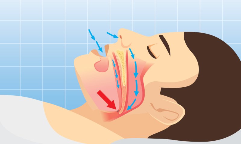 נוחרים? זו אזעקת אזהרה מהגוף שכדאי לכם לשים לב אליה